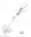Fig. 03 - Large bore anchor device
