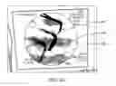 Fig. 64 - SURGICAL INSTRUMENT COMPATIBLE WITH OPERATING ROOM EQUIPMENT