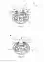 Fig. 07 - Device for reducing the retraction of a fascia or a soft tissue mantle in an open soft tissue defect