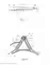 Fig. 08 - Device for reducing the retraction of a fascia or a soft tissue mantle in an open soft tissue defect