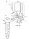 Fig. 12 - Integrated retractor-distractor system for use with modular bone screws