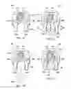Fig. 13 - Integrated retractor-distractor system for use with modular bone screws