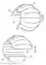 Fig. 15 - Integrated retractor-distractor system for use with modular bone screws