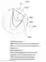 Fig. 01 - Auxiliary apparatus for minimally invasive surgery and method to use the same