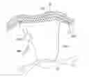 Fig. 01 - System for intra-abdominally moving an organ