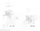 Fig. 13 - System for intra-abdominally moving an organ