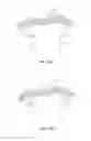 Fig. 16 - System for intra-abdominally moving an organ