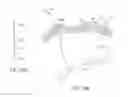 Fig. 19 - System for intra-abdominally moving an organ