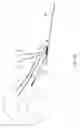 Fig. 18 - Transosseous suture anchor