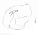 Fig. 21 - Transosseous suture anchor