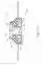 Fig. 46 - Methods for partial diversion of the intestinal tract