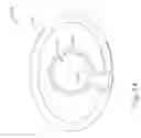 Fig. 49 - Methods for partial diversion of the intestinal tract