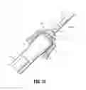 Fig. 09 - Surgical apparatus and structure for applying sprayable wound treatment material