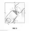 Fig. 10 - Surgical apparatus and structure for applying sprayable wound treatment material