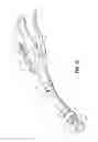Fig. 11 - Surgical apparatus and structure for applying sprayable wound treatment material