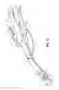 Fig. 18 - Surgical apparatus and structure for applying sprayable wound treatment material