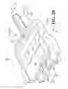 Fig. 13 - Extremity tourniquet with locking buckle
