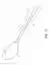 Fig. 40 - Axial lengthening thrombus capture system