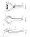 Fig. 11 - Instruments, devices, and related methods for soft tissue dissection