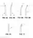 Fig. 06 - Systems and methods for endoluminal valve creation