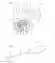 Fig. 02 - Methods for thread transection of a soft tissue