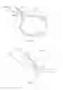 Fig. 02 - TISSUE RESECTION SNARES