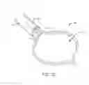 Fig. 03 - TISSUE RESECTION SNARES