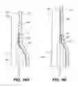 Fig. 12 - Systems and methods for endoluminal valve creation