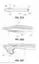 Fig. 19 - Systems and methods for endoluminal valve creation