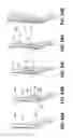 Fig. 40 - Systems and methods for endoluminal valve creation