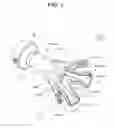 Fig. 02 - TREATMENT INSTRUMENT INSERTION ASSISTING TOOL