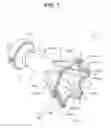 Fig. 08 - TREATMENT INSTRUMENT INSERTION ASSISTING TOOL