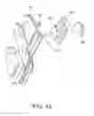 Fig. 45 - Posterior spinal stabilization plate device