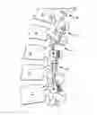 Fig. 01 - Spinal stabilization system