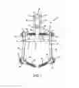 Fig. 02 - Spinal stabilization system