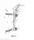 Fig. 04 - Spinal stabilization system
