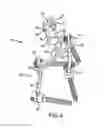 Fig. 05 - Spinal stabilization system
