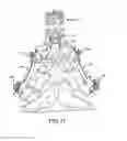 Fig. 12 - Spinal stabilization system