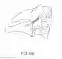 Fig. 131 - Vertebral joint implants and delivery tools