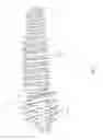 Fig. 19 - Reversible bone coupling device and method