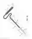 Fig. 10 - INTRAMEDULLARY IMPLANT, SYSTEM, AND METHOD FOR INSERTING AN IMPLANT INTO A BONE