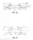 Fig. 17 - INTRAMEDULLARY IMPLANT, SYSTEM, AND METHOD FOR INSERTING AN IMPLANT INTO A BONE