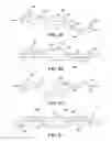 Fig. 24 - INTRAMEDULLARY IMPLANT, SYSTEM, AND METHOD FOR INSERTING AN IMPLANT INTO A BONE