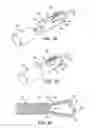 Fig. 26 - INTRAMEDULLARY IMPLANT, SYSTEM, AND METHOD FOR INSERTING AN IMPLANT INTO A BONE