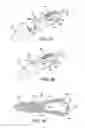 Fig. 27 - INTRAMEDULLARY IMPLANT, SYSTEM, AND METHOD FOR INSERTING AN IMPLANT INTO A BONE