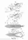 Fig. 28 - INTRAMEDULLARY IMPLANT, SYSTEM, AND METHOD FOR INSERTING AN IMPLANT INTO A BONE