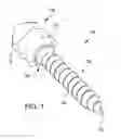 Fig. 02 - Orthopedic implant kit