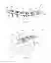 Fig. 06 - System and method for minimally invasive clavicle plate application