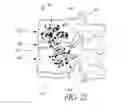 Fig. 08 - Minimally invasive spinal fusion system and method