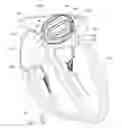 Fig. 01 - Enhanced medical device for use in bodily cavities, for example an atrium